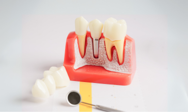 Implant