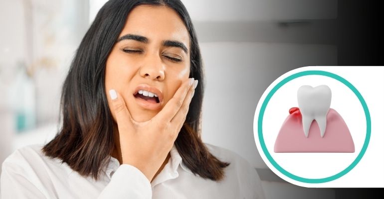 gum-treatment